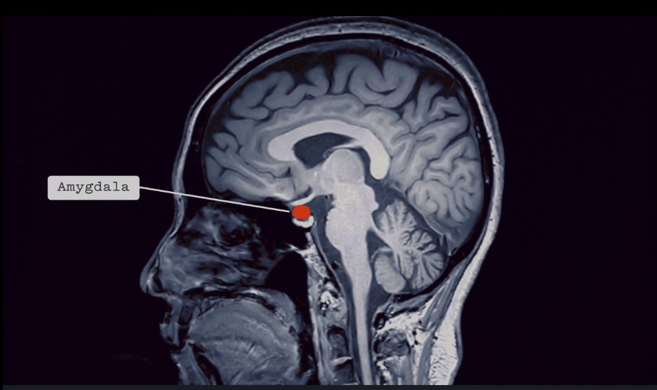 In the class, Chris Voss explains the role of the amygdala in labeling.